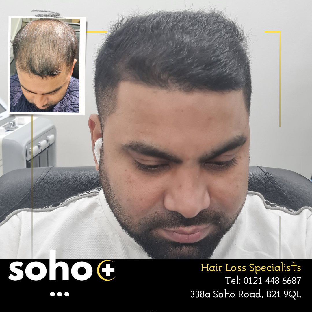 Hair Matrix Banner CTA